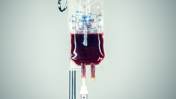 Blood Transfusion Trial and Errors Through the Ages Blood Transfusion Trial and Errors Through the Ages