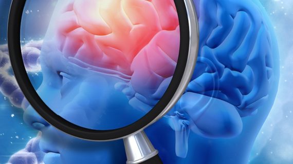 inflamed brain Chronic Inflammation in Alzheimer’s Disease