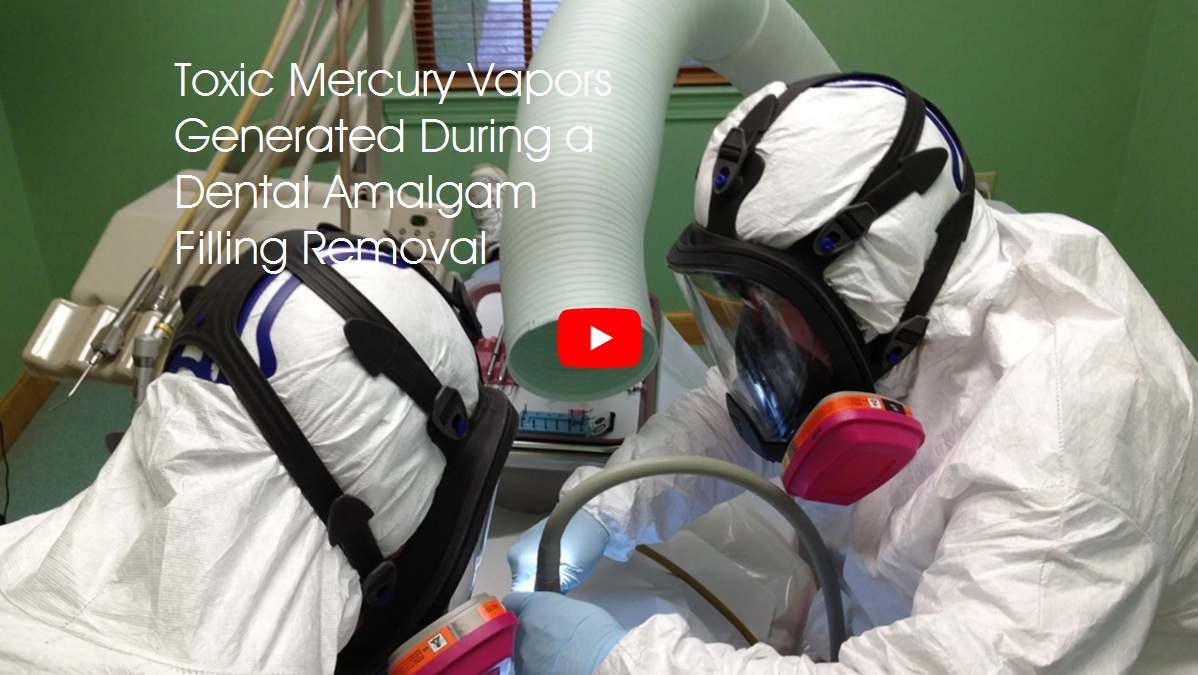 mercuryvaporsfromamalgamfillingremoval The Vaccine Reaction