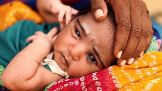Indian baby Three Children in India Die After JE, Measles and DPT Vaccinations