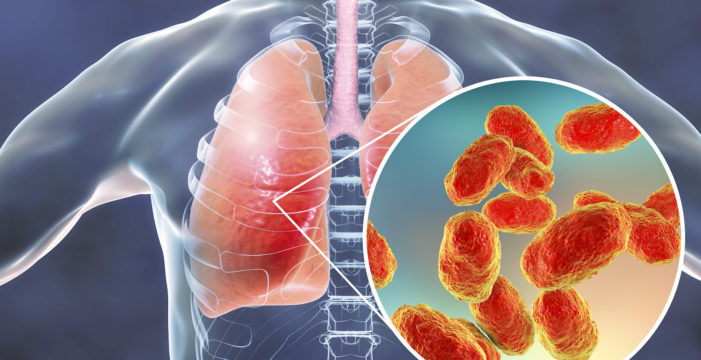 Hib in lungs Has the Hib Vaccine Simply Shifted the Risk Burden to the Elderly?