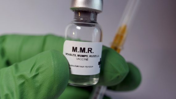 MMR vaccine Wild vs Artificial Exposure to Measles are Not Equal