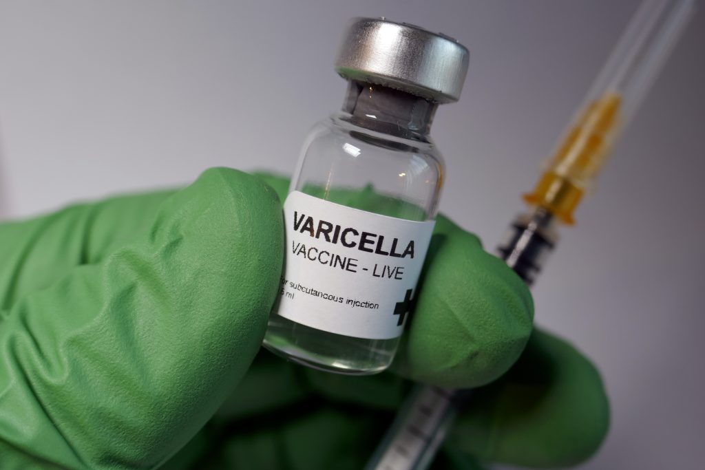 varicella vaccine