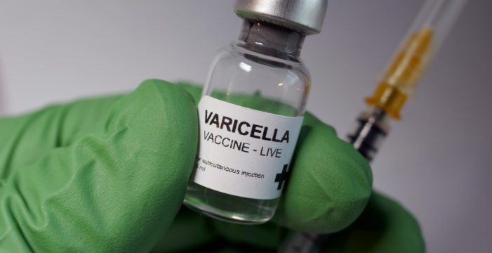 varicella vaccine Is the Chickenpox Vaccine Creating a Shingles Epidemic?