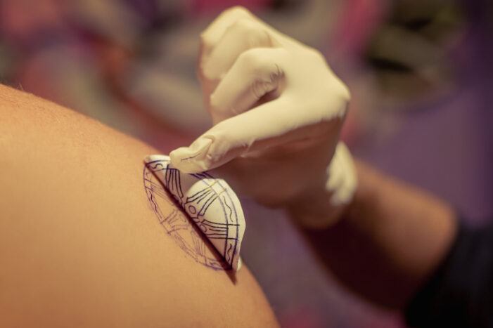Smallpox Infection Via Tattoo