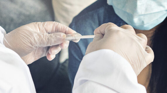 rectal swab Anal Swabs Used to Test for SARS-CoV-2 Virus in China