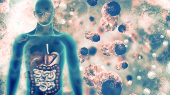 human body and cancer cells Bayer Pressures Mexico to Lift Ban on Glyphosate