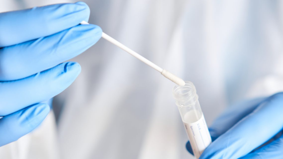 Coronavirus Testing Company Sued for False Test Results