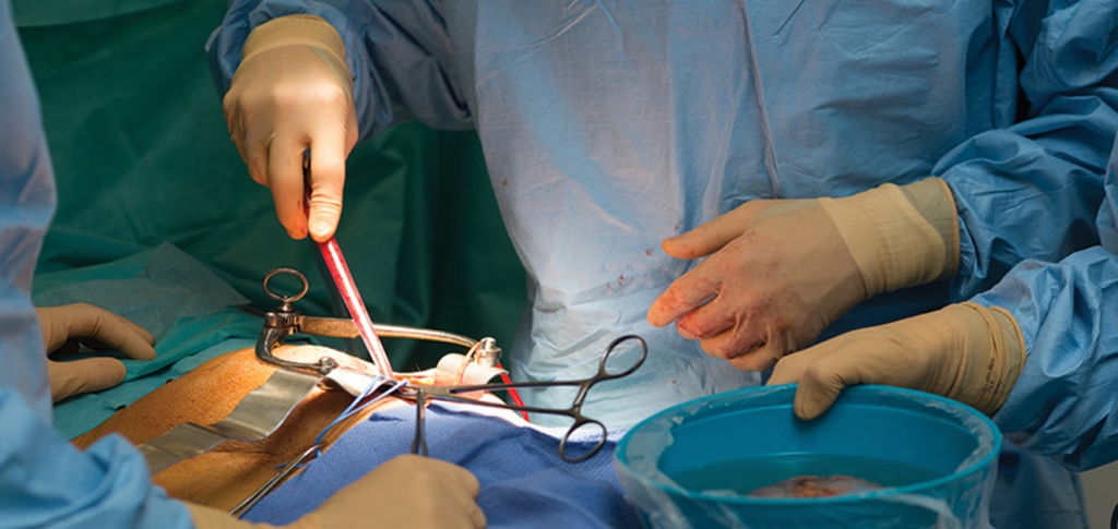 kidney transplant operation
