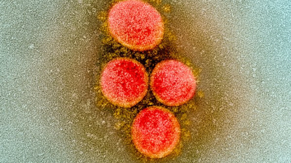 WHO to Rename Monkeypox Virus to Prevent Stigma Associated with the Virus
