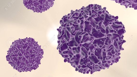 poliovirus Polio Case in New York Caused by “Vaccine-Derived” Poliovirus