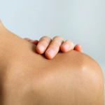 melanoma cancer
